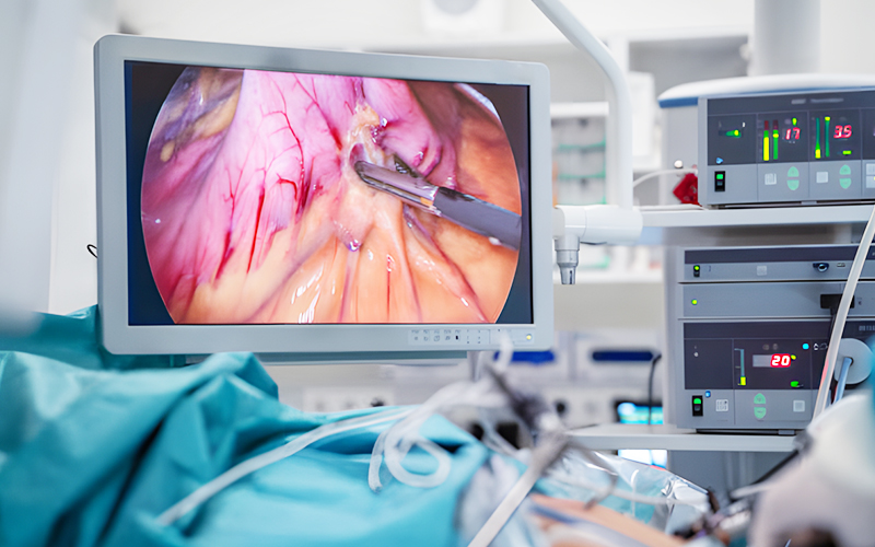 Medical & Healthcare-Monitors – Touch, Openframe, Industrial